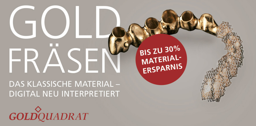 Goldfräsen verbindet bewährtes Material und moderne Technologie