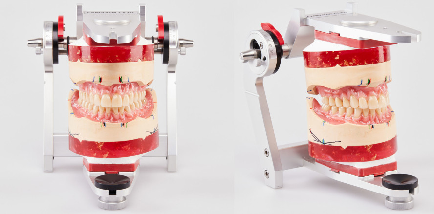 Totalprothetik: Handwerkliches Können und individuelle Vorgaben