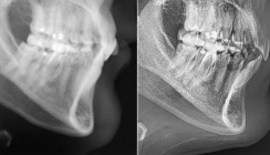 Exzellenz und Evidenz in der Patientenversorgung mit Lingualer Orthodontie