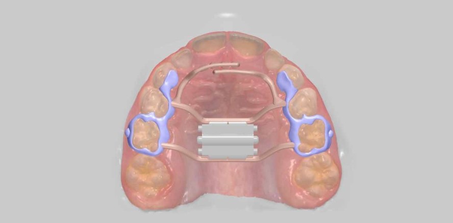 3xDGNE – Effizientes Duo aus bewährter Technik und moderner Technologie