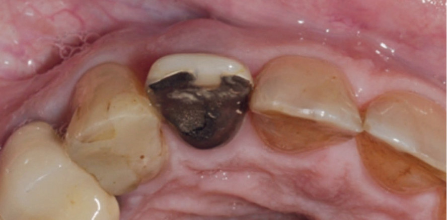 Die ästhetische Zone effektiv gestalten