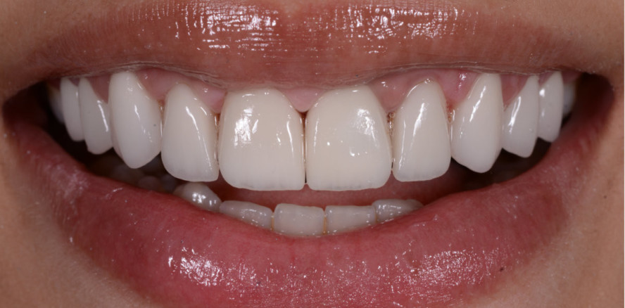 Die Rot-Weiß-Ästhetik – der Rahmen eines perfekten Lächelns