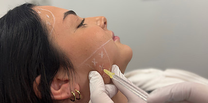 Botulinumtoxin in der maxillofazialen Chirurgie: Potenziale, Grenzen und klinische Relevanz