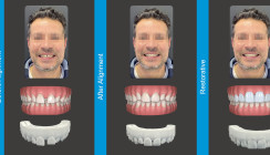 Digitalisierung in der Zahnmedizin: Software zum perfekten Lächeln