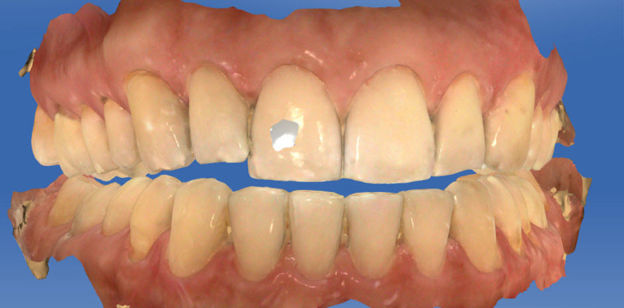 Digitale Bissnahme: Chancen und Grenzen des digitalen Workflows