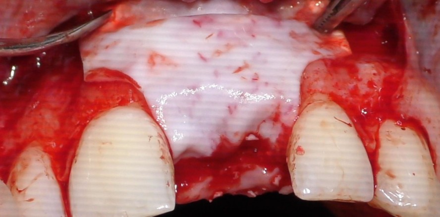 Moderne Augmentationskonzepte – Bewährtes und Neues