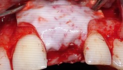 Moderne Augmentationskonzepte – Bewährtes und Neues