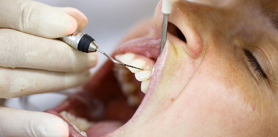 Konsequente Diagnostik –  Vermeidung einer Periimplantitis