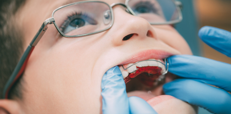 KFO-Behandlung: Der lange Weg zur Versorgungsforschung