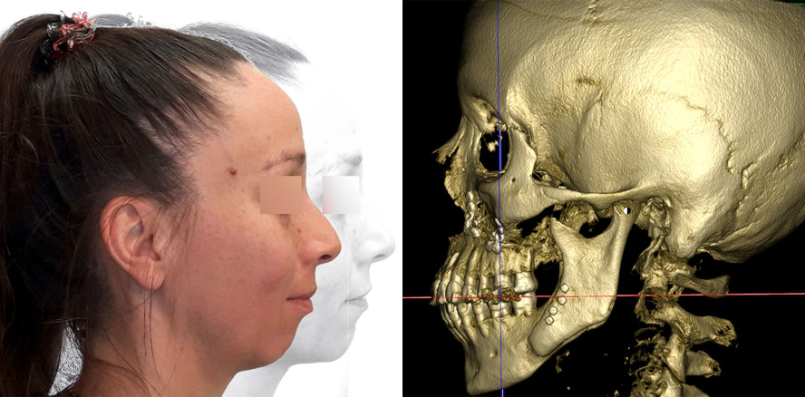 Der Sunday Bite als diagnostische Falle