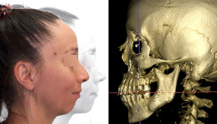 Der Sunday Bite als diagnostische Falle