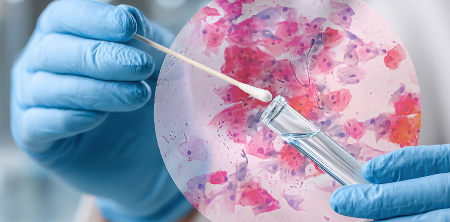 Diagnostik: Vom Biofilm zur Prognose – Was benötigen wir in der klinischen Praxis?