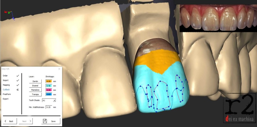 Die Keramikabteilung: eine CAD-freie Zone?
