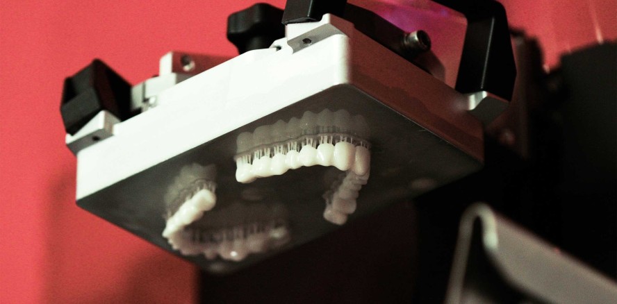 Digitale Zahntechnik: Interimsprothesen digital gefertigt