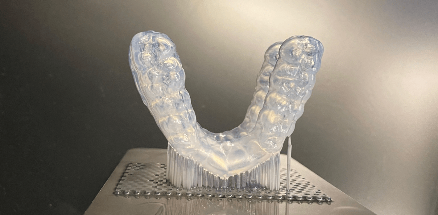 Digitale Herstellung von Aufbissschienen: Ein praxisnaher Workflow von Scan bis Druck