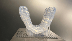 Digitale Herstellung von Aufbissschienen: Ein praxisnaher Workflow von Scan bis Druck