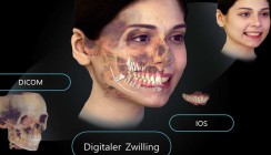 Digitaler Workflow: Gesichtsscan und digitaler Zwilling