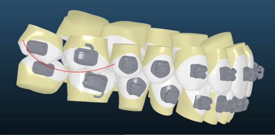 Vom digitalen Set-up zum idealen Finishing