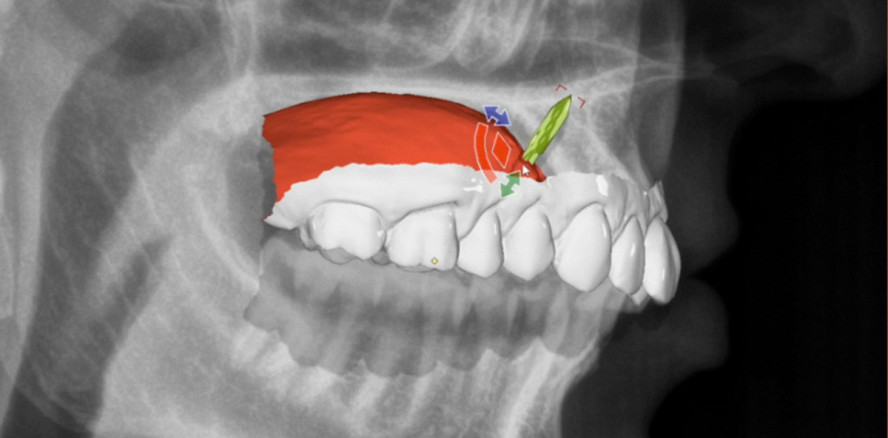 Virtuell geplant, exakt umgesetzt