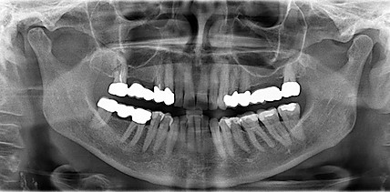 Die Entwicklung von Biokeramiken – Teil 1
