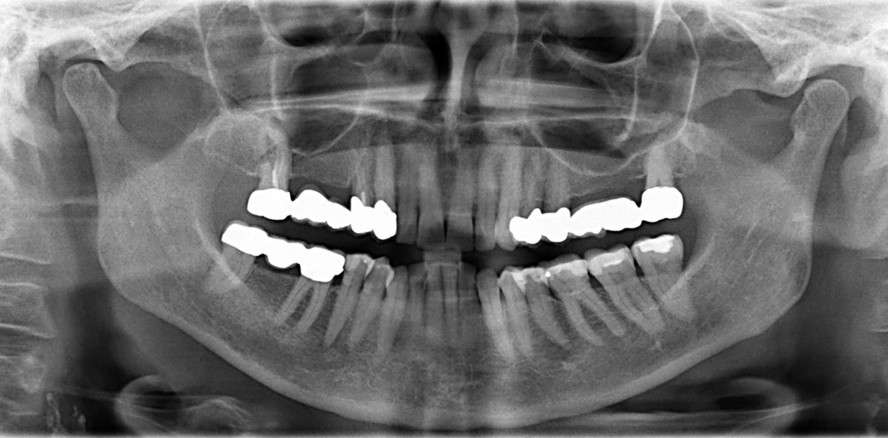 Die Entwicklung von Biokeramiken – Teil 1