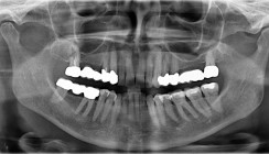 Die Entwicklung von Biokeramiken – Teil 1
