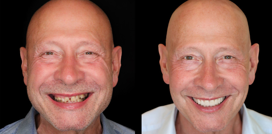 The Facial Aesthetic Concept: Ein neuer Ansatz in der dentalen Gesamtrehabilitation