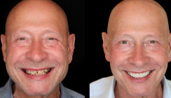 The Facial Aesthetic Concept: Ein neuer Ansatz in der dentalen Gesamtrehabilitation