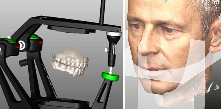 Gesichtsscan als entscheidender Faktor im funktionellen digitalen Workflow