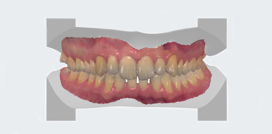 Steigerung von Wertschöpfung und Kontrolle durch Inhouse-Aligner