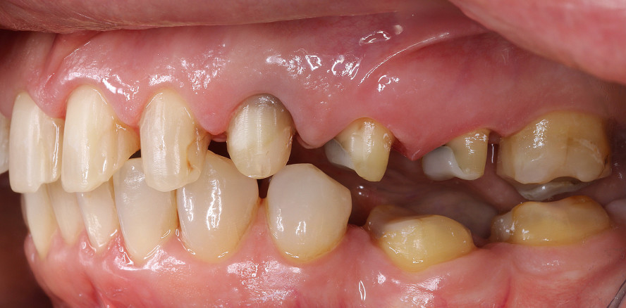 Integration digitaler Technologien in der ästhetischen Rehabilitation