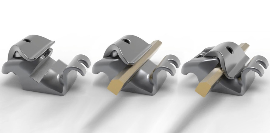 Angulationskontrolle pur – das neue selbstligierende WIN-Bracket