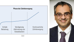 Beschleunigte Zahnbewegung oder doch nur ein Placeboeffekt?