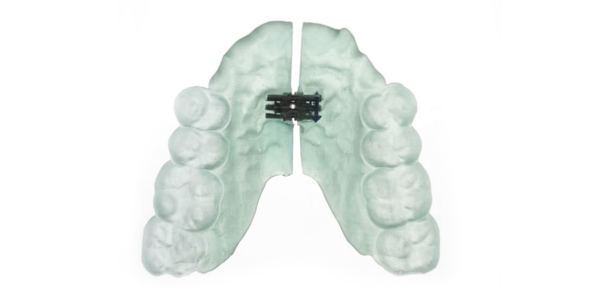 3D-Druck – wirklicher Vorteil oder digitaler Hype?