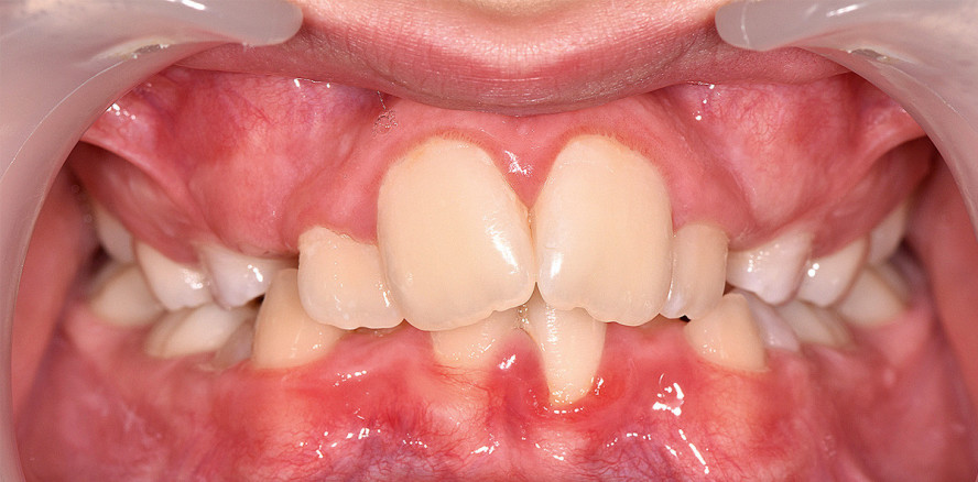 Rethink KFO: Neue Herausforderungen erfordern Umdenken