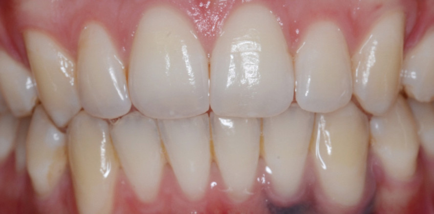 Die computerunterstützte Behandlungsanalyse – CUBA