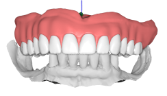 Kombiarbeit und digitale Totalprothetik – Effizienz durch CAD/CAM mit SLM-Verfahren