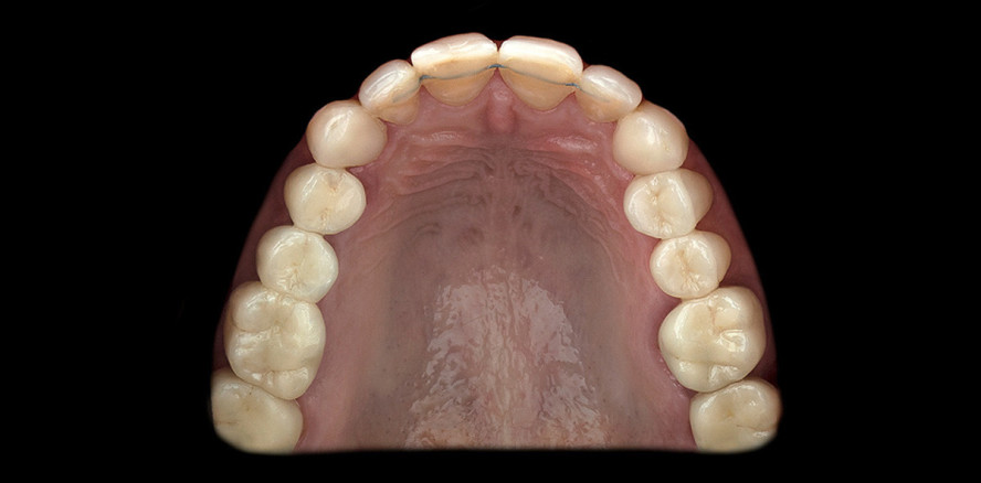 Interdisziplinäre Zusammenarbeit für ein perfektes Lächeln