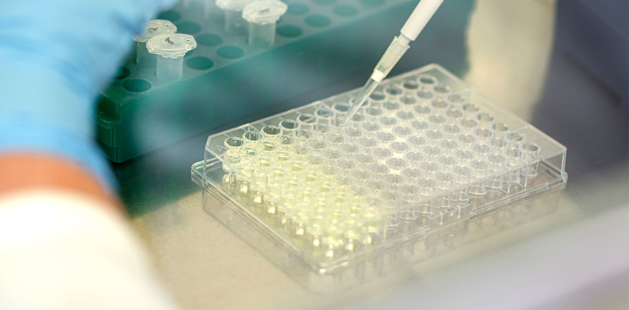 Pathoblocker-basierte Virulenzmodulation von Porphyromonas gingivalis