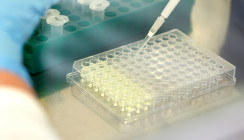 Pathoblocker-basierte Virulenzmodulation von Porphyromonas gingivalis