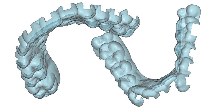 Laborgefertigte Positionierungsschablone