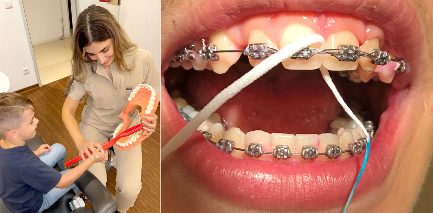 Prophylaxe im Lebenszyklus – Vom ersten Zahn bis ins hohe Alter