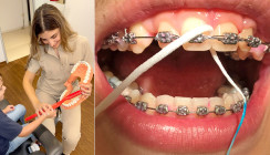 Prophylaxe im Lebenszyklus – Vom ersten Zahn bis ins hohe Alter