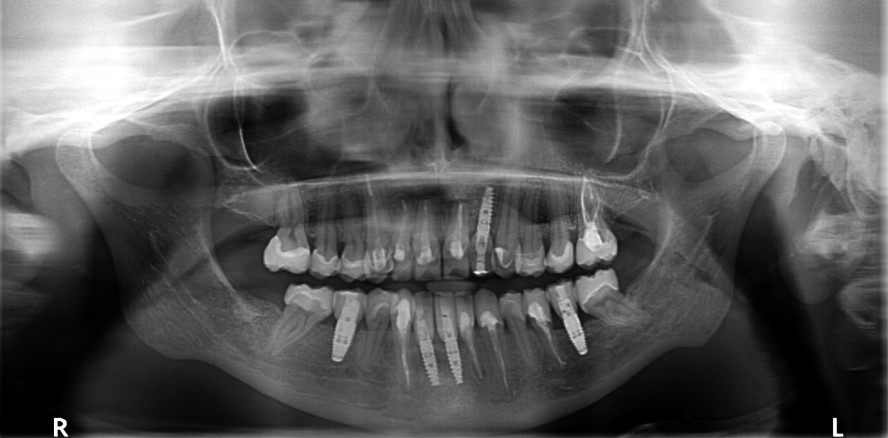 Sanierungskonzept im Fokus der Ästhetik und Funktion