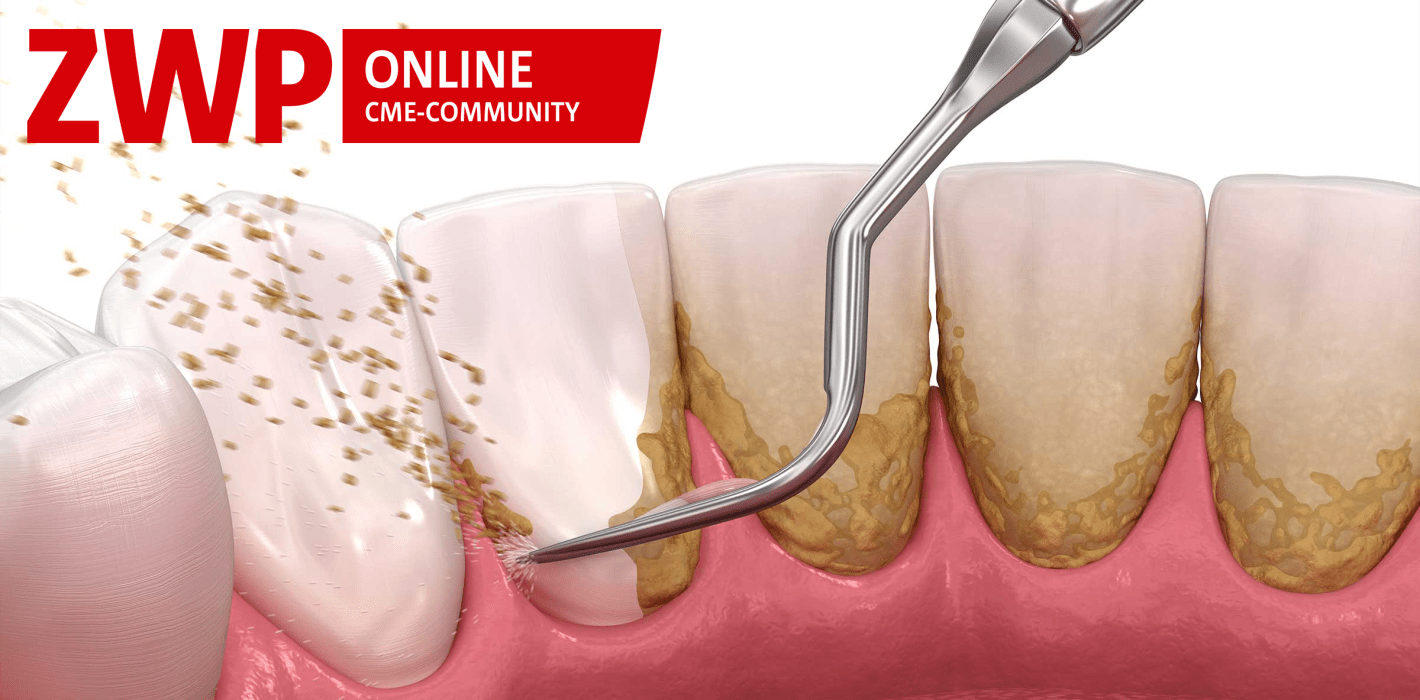 Schmelz-Matrix-Proteine in der Dentalhygiene?