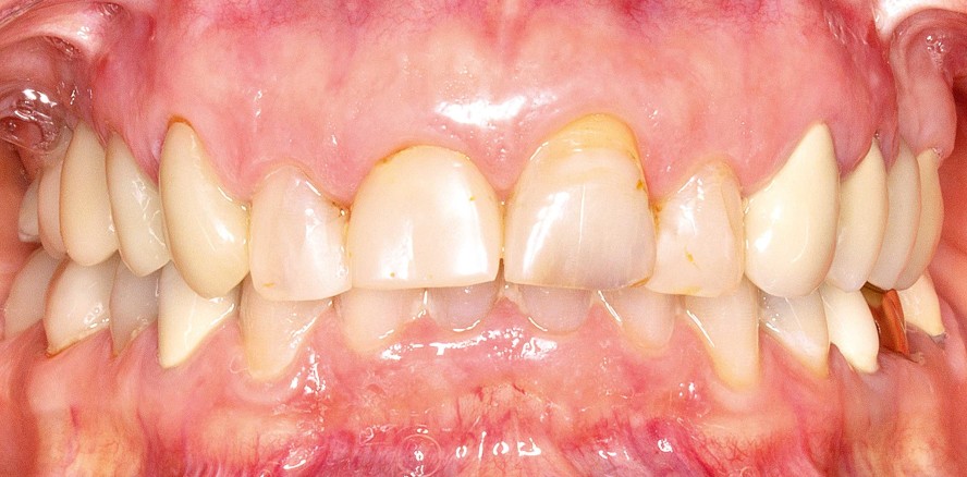 Komfortable Behandlung durch digitalen Workflow