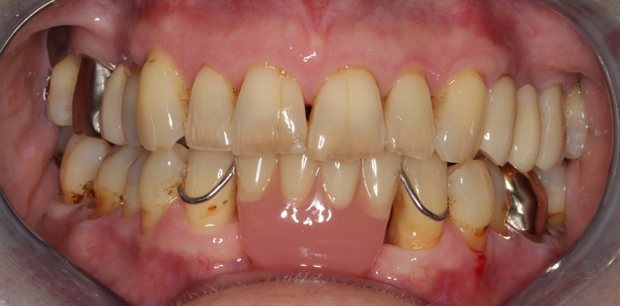 Interdisziplinäre Ansätze zur Diagnostik und Behandlung von Mundtrockenheit