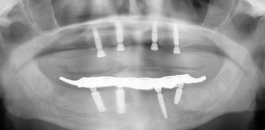 (Sofort-)Versorgung – Anforderung, Umsetzung und Alltag