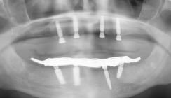 (Sofort-)Versorgung – Anforderung, Umsetzung und Alltag