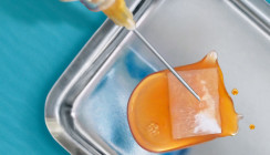 Mythos oder Magie? Biologisierung mit Eigenblutkonzentrat